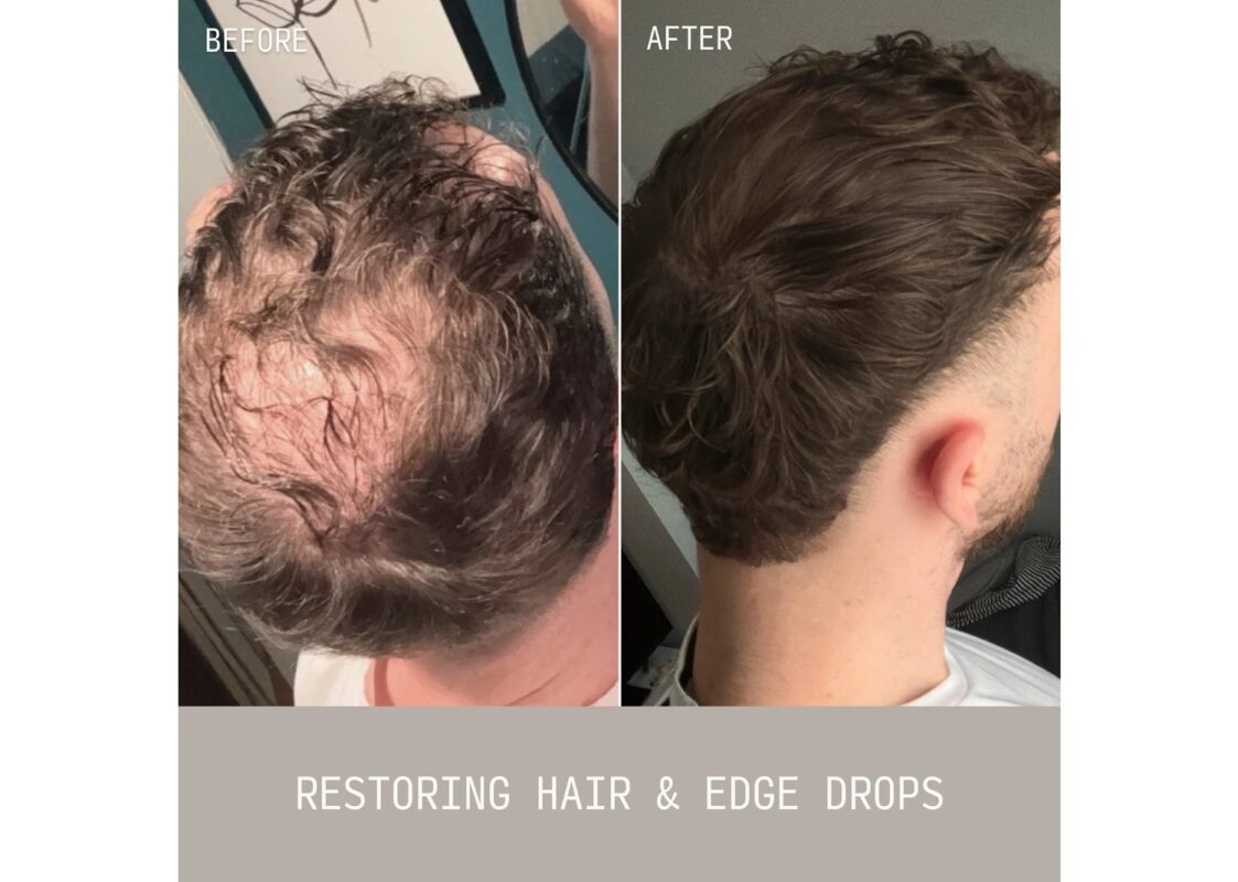 Cécred Restoring Hair & Edge Drops 2