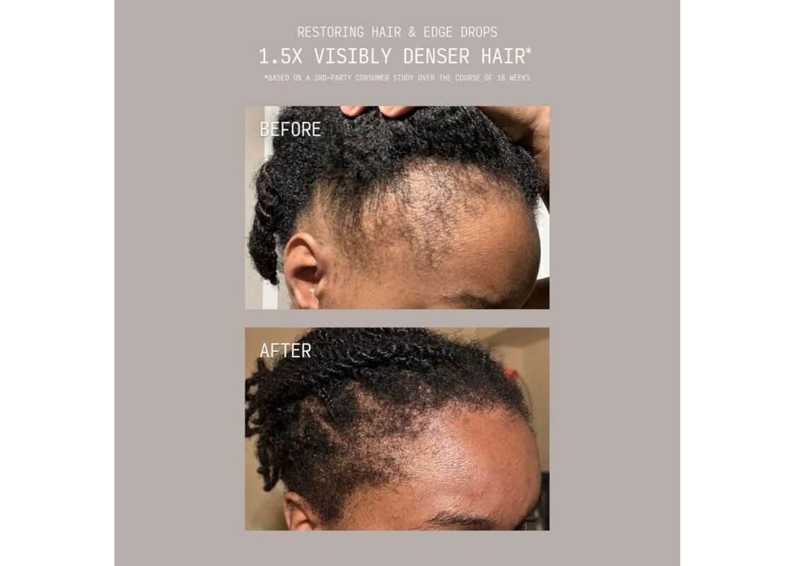 Cécred Restoring Hair & Edge Drops 3