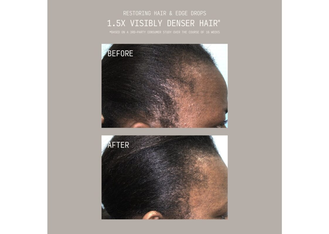 Cécred Restoring Hair & Edge Drops 8